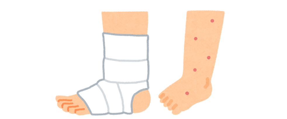 Differences in Wearing Roll Splints and Starfix Splints